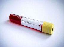 ۲۸۰۰ کیت تشخیص کرونا وارد کشور شد