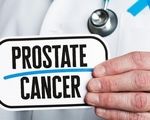 آیا سرطان پروستات بدخیم کشنده است؟ تشخیص زودهنگام چه نقشی دارد؟